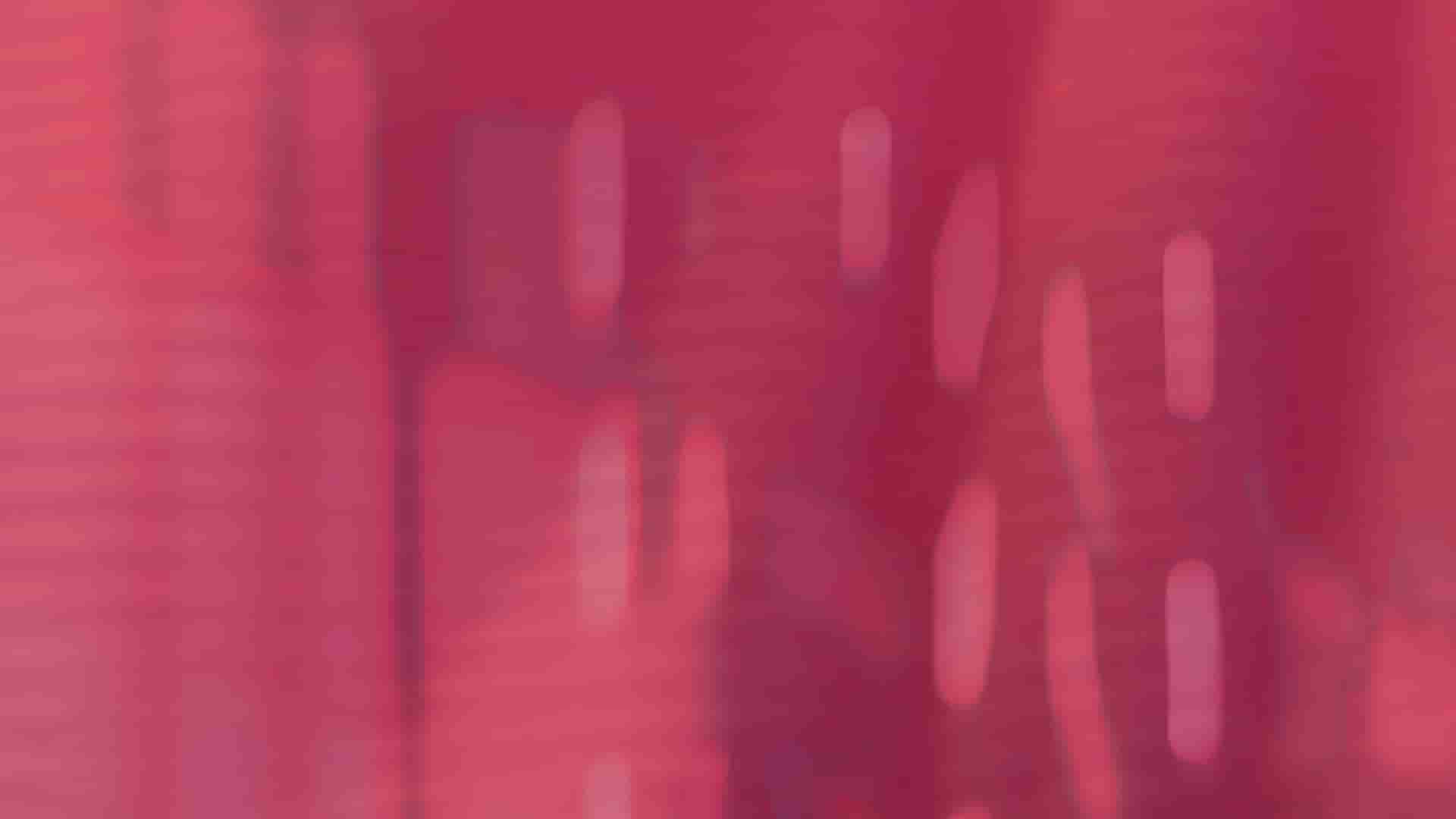 Rot